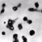 Transmission electron micrograph of varicella-zoster virions from vesicle fluid of patient with chickenpox.